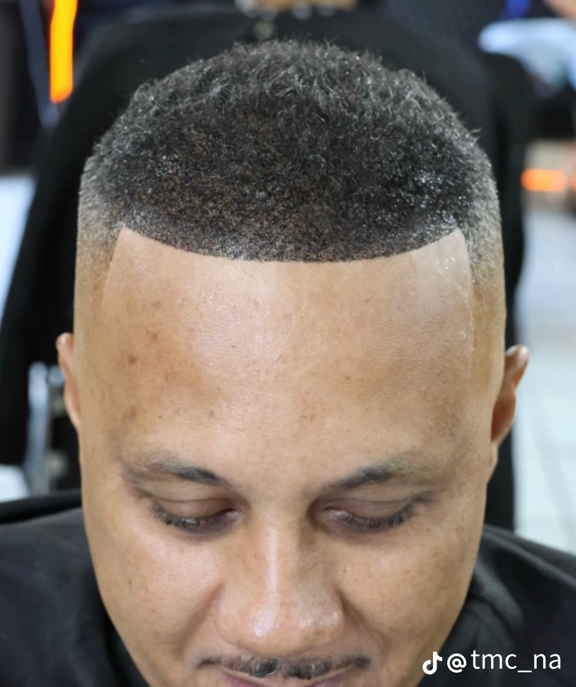 Hairline after application