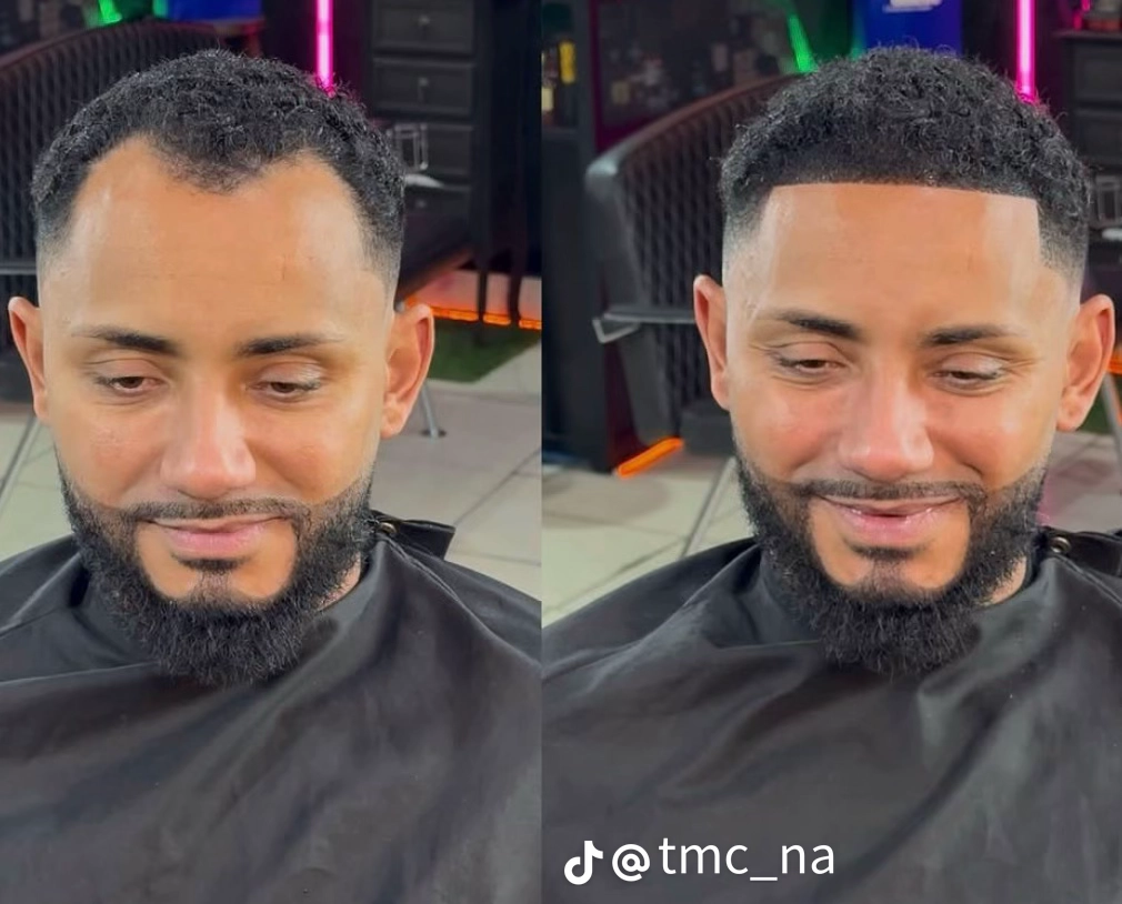 Hair fibres being applied to a thinning crown